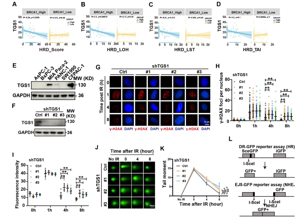 胰腺癌“癌王”耐药机制新突破:ATM-TGS1-BRCA1轴揭秘,奥拉帕利联合Sinefungin带来治疗新希望 2 图片