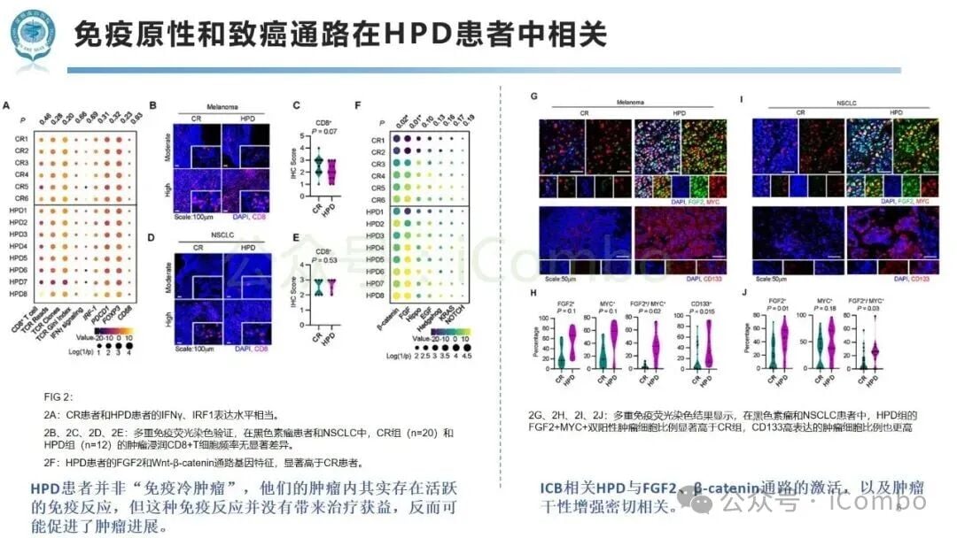 免疫检查点阻断治疗中肿瘤超进展(HPD)新机制:免疫与代谢互作如何影响黑色素瘤与非小细胞肺癌患者预后? 8 图片