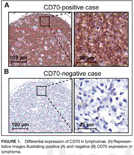 淋巴瘤靶向治疗新工具:CD70免疫PET/CT精准评估表达异质性与疗效监测 2 image.png