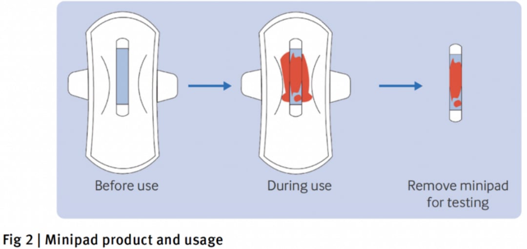 宫颈癌筛查告别尴尬:BMJ重磅揭示月经血HPV检测,居家自测,准确率高! 3 特制迷你卫生巾采集装置用于月经血HPV检测