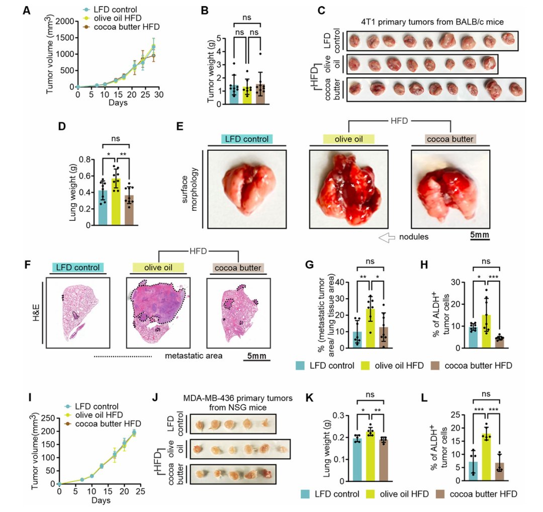 警惕!过量橄榄油或促三阴性乳腺癌(TNBC)转移?最新研究揭示饮食与癌症真相 2 橄榄油高脂饮食促进三阴性乳腺癌肺转移的关键机制图
