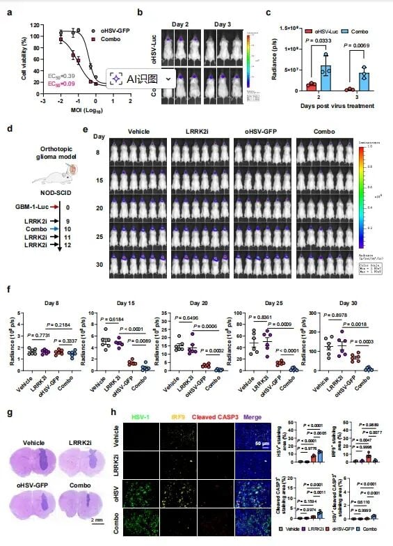 帕金森药物竟能“助攻”脑瘤治疗?夏宁邵团队Nature子刊发文:LRRK2抑制剂协同溶瘤病毒,胶质母细胞瘤迎来新曙光 7 图6:PDX原位脑瘤小鼠模型验证了联合疗法显著延长生存期并抑制肿瘤生长