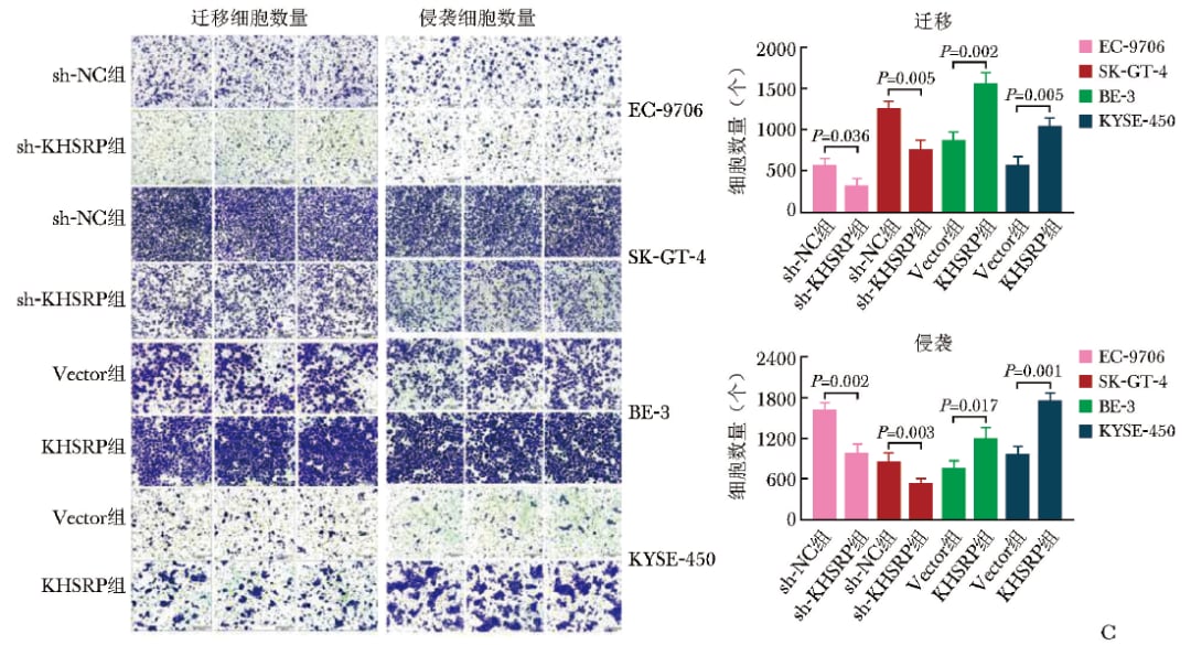 食管鳞状细胞癌侵袭转移新机制:KHSRP通过JAK1/STAT3促进恶化如何影响治疗 4 KHSRP促进食管鳞状细胞癌细胞迁移侵袭的Transwell实验图