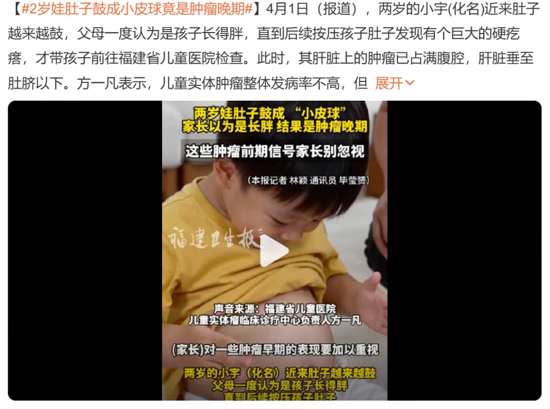 肝母细胞瘤怎么早发现?儿童腹部隆起识别、检查与治疗全指南 1 儿童肝母细胞瘤导致腹部明显隆起的警示示意
