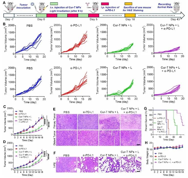 姜黄素变身“抗癌炸弹”?国产Cur-T光敏剂通过铁死亡围剿肿瘤 5 图10:Cur-T NPs联合PD-L1抑制剂治疗原发与转移肿瘤的实验结果