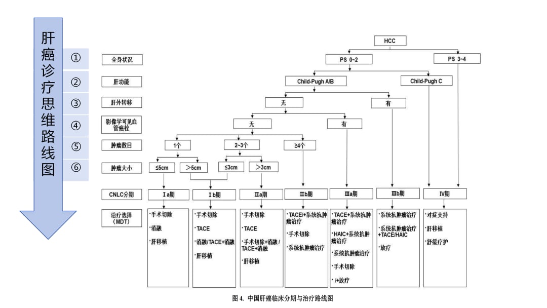 原发性肝癌诊疗指南2026版CNLC分期与治疗推荐流程图