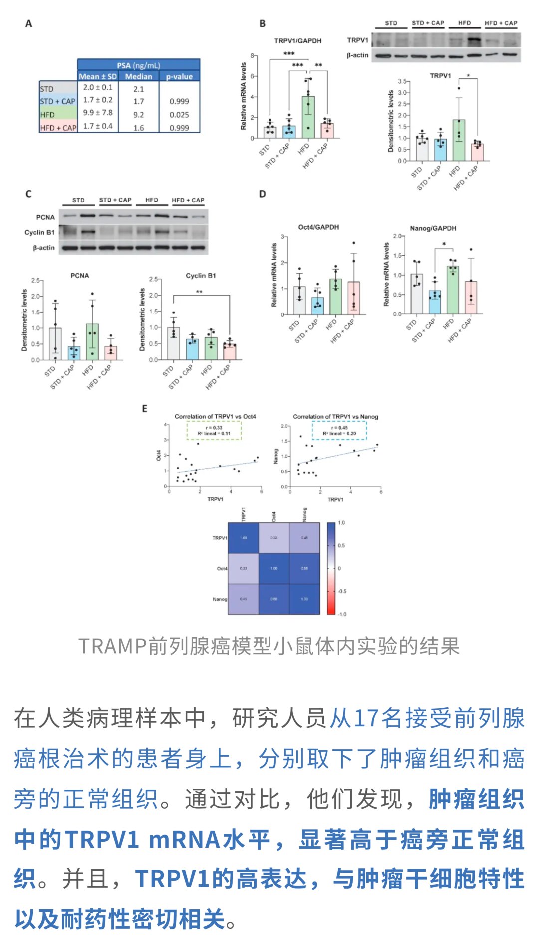 前列腺癌患者体内TRPV1表达与疾病恶性程度及治疗耐药相关性分析