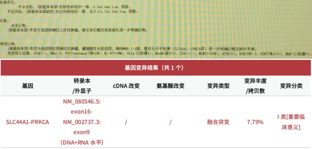 低级别胶质神经元肿瘤患者病理诊断及基因检测结果分析