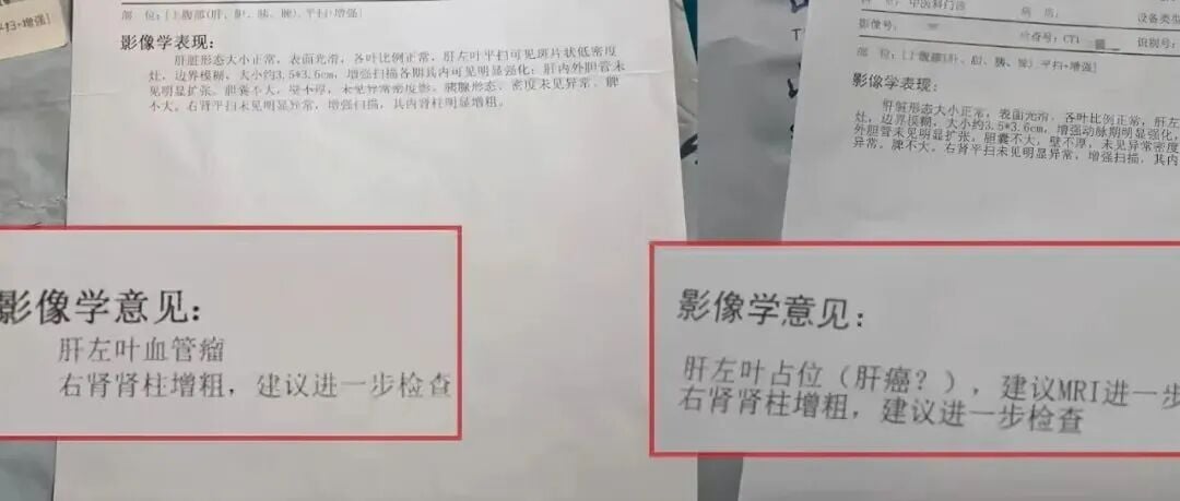 肝脏CT影像诊断与双审核流程