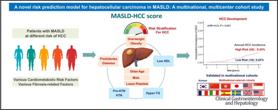 MASLD-HCC肝癌风险预测模型跨国研究成果发表