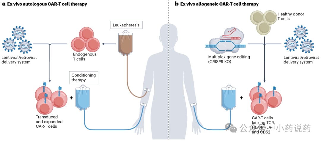 体内CAR工程与体外CAR-T疗法流程对比示意图
