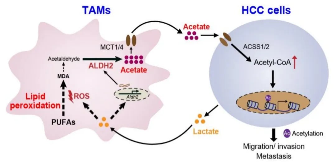 揭秘肝癌转移元凶:肿瘤相关巨噬细胞竟是癌细胞的“乙酸供应站” 2 图片