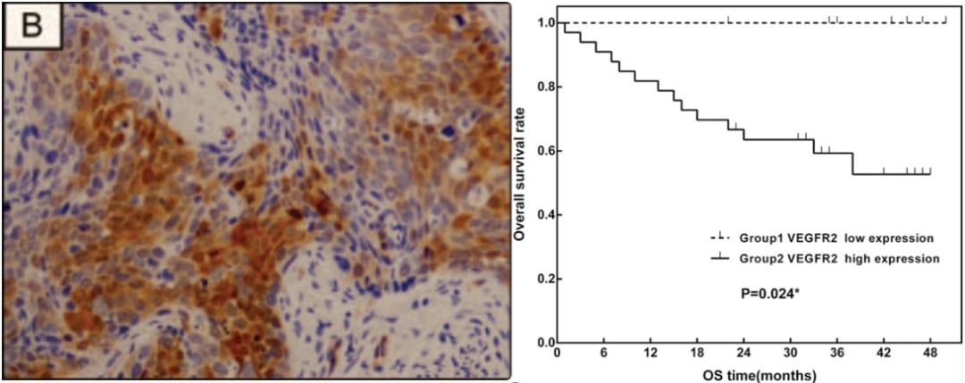 法米替尼联合新疗法获批,显著延长晚期宫颈癌患者生存期 3 c0124a5a67774878a3e7257247f5165c-Z0COlCw