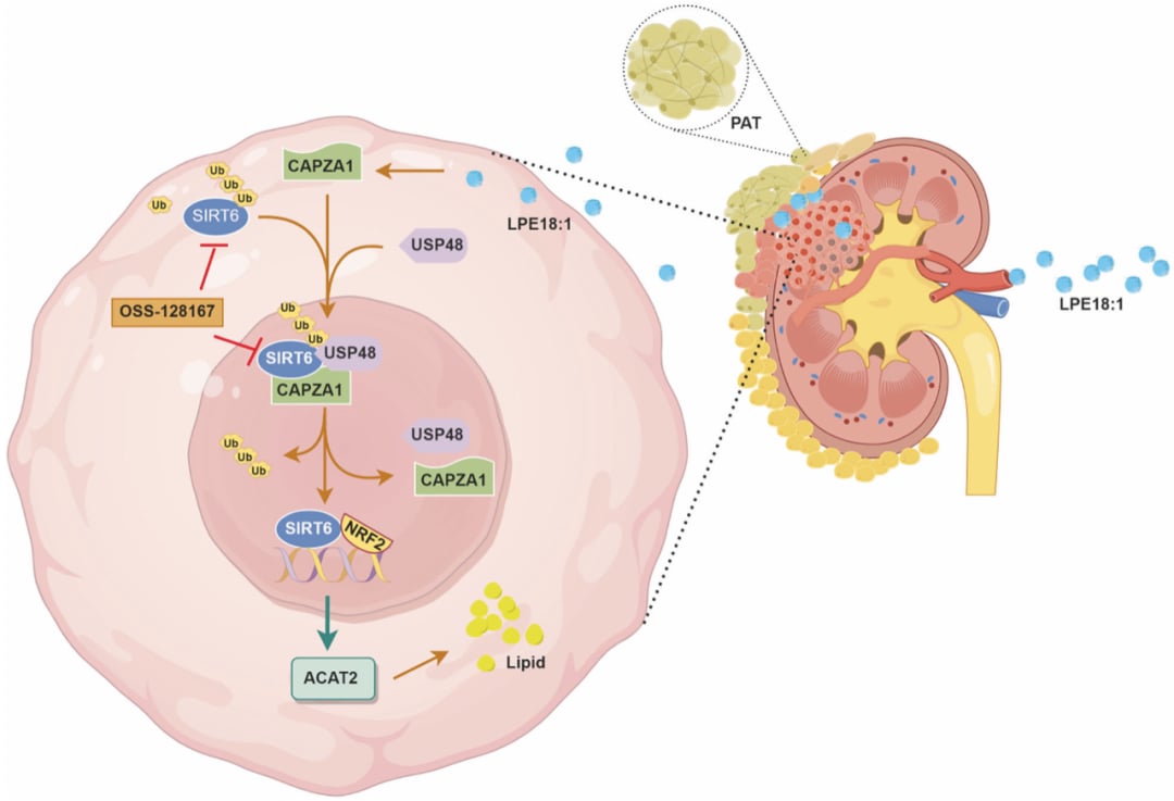 透明细胞肾细胞癌新靶点:LPE18:1驱动肿瘤进展,CAPZA1/SIRT6靶向治疗前景广阔 2 ac90659376264406a8aefbb18a5fe8f6-nn2pPai