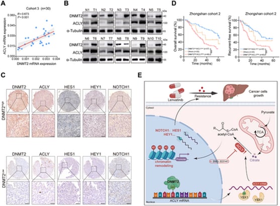 仑伐替尼治疗肝癌耐药怎么办?新研究揭示DNMT2-ACLY轴,联合用药突破瓶颈 2 427393fdb8a8402cbe8ba6cbc3a6f7f7-vyj72ir