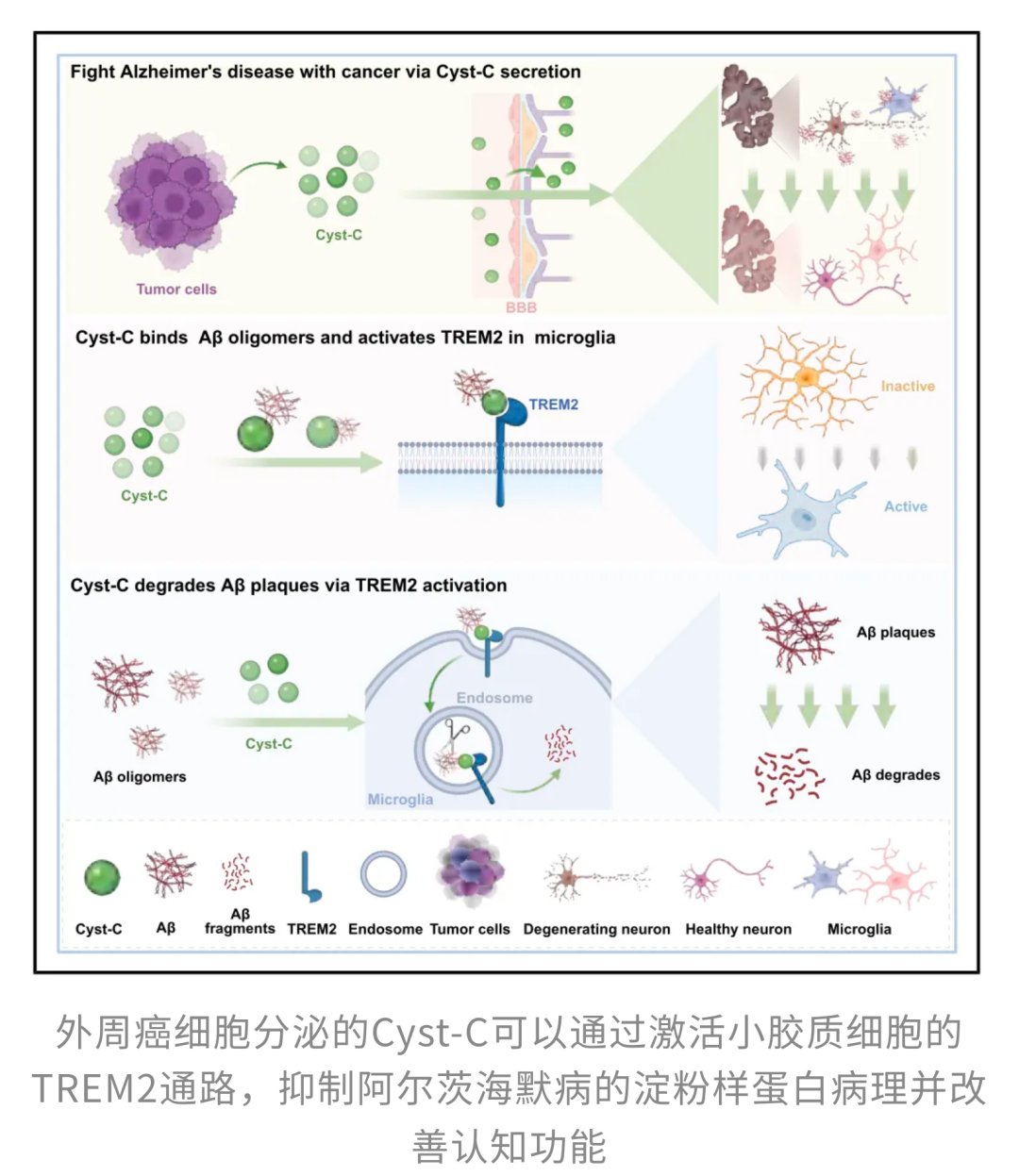 癌症也能“防痴呆”?Cell新研究:肿瘤分泌Cyst-C,有望清除大脑“垃圾”,改善阿尔茨海默病认知! 9 0a179a257eed475fb7b61a2915659a46-4ZryGwO
