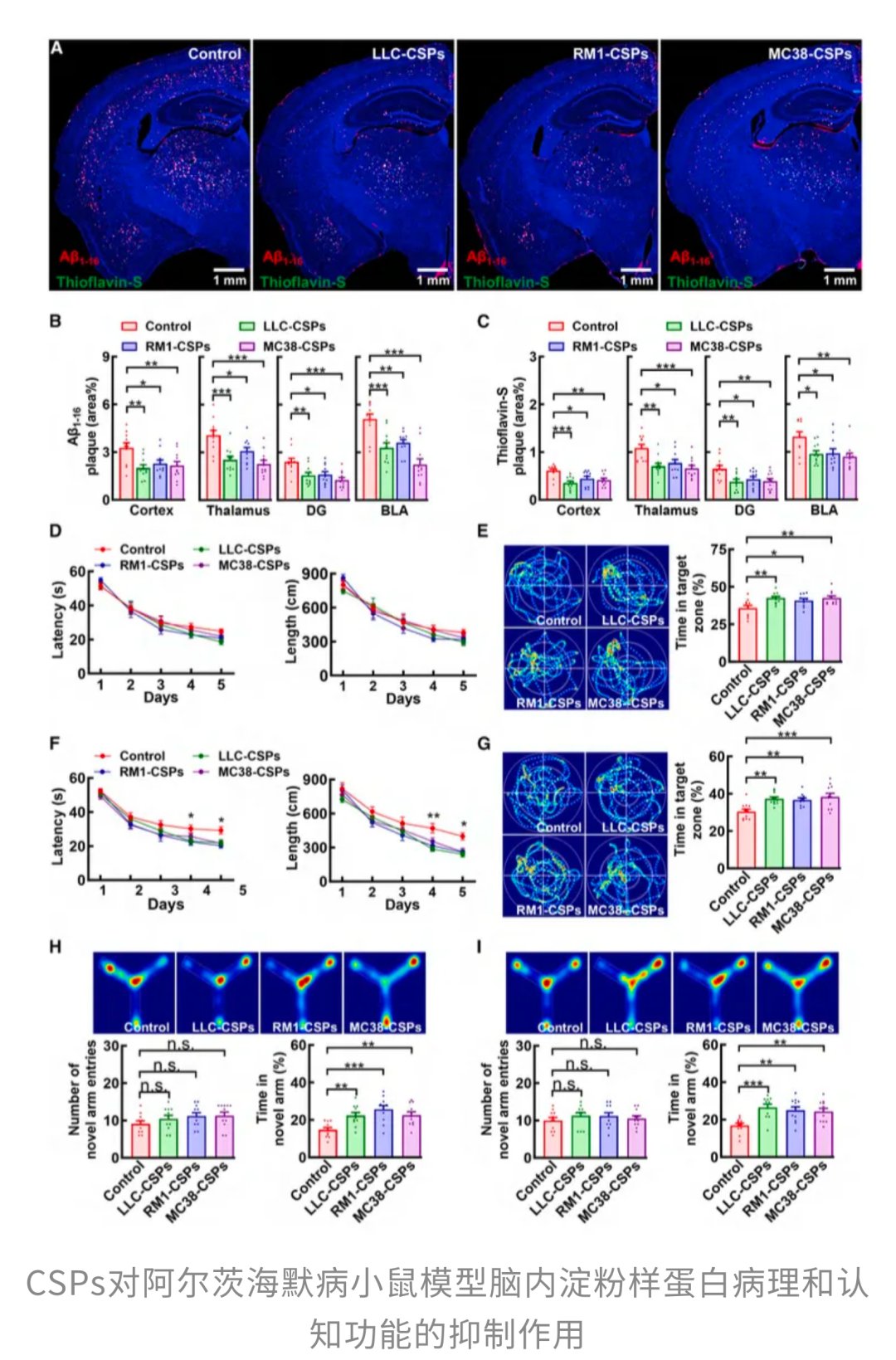 癌症也能“防痴呆”?Cell新研究:肿瘤分泌Cyst-C,有望清除大脑“垃圾”,改善阿尔茨海默病认知! 4 573d596bebd64d9386a2cbaad3efb086-UmhY65u
