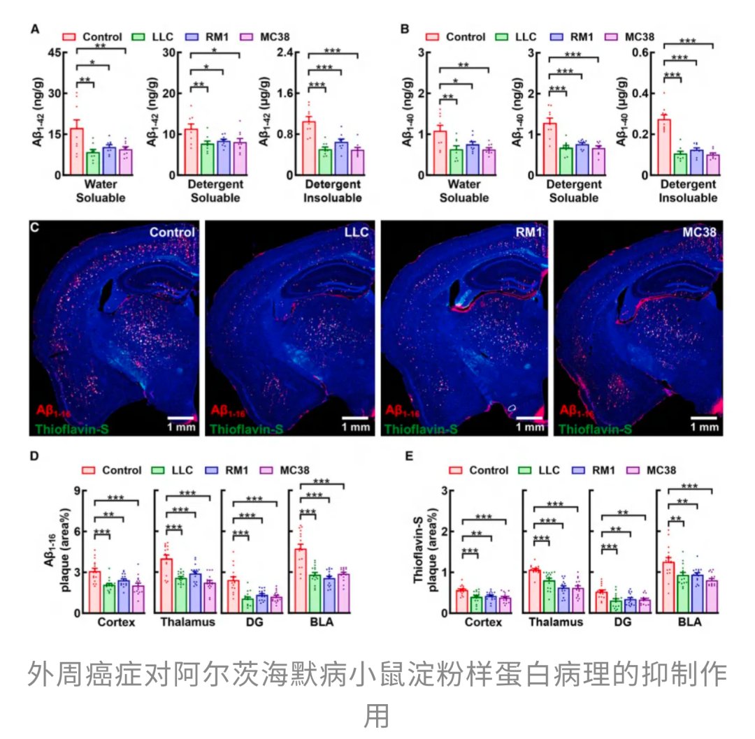 癌症也能“防痴呆”?Cell新研究:肿瘤分泌Cyst-C,有望清除大脑“垃圾”,改善阿尔茨海默病认知! 3 7117d36522f545c49a4f5b9c6d6abafe-3gvuV11