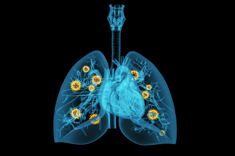 frc daf07ee30ead6e0d9253bc1640681415