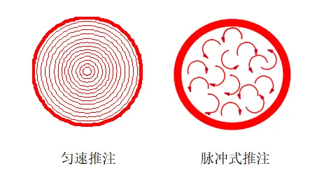 经输液港输液,6 个最容易被忽略的冷知识 12 图片