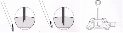 经输液港输液,6 个最容易被忽略的冷知识 2 图片