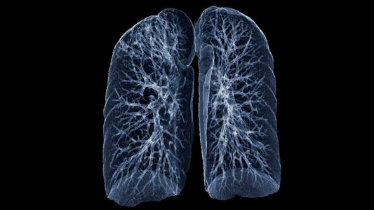 肺癌筛查率为何远落后于乳腺癌和结直肠癌？最新研究揭示背后原因