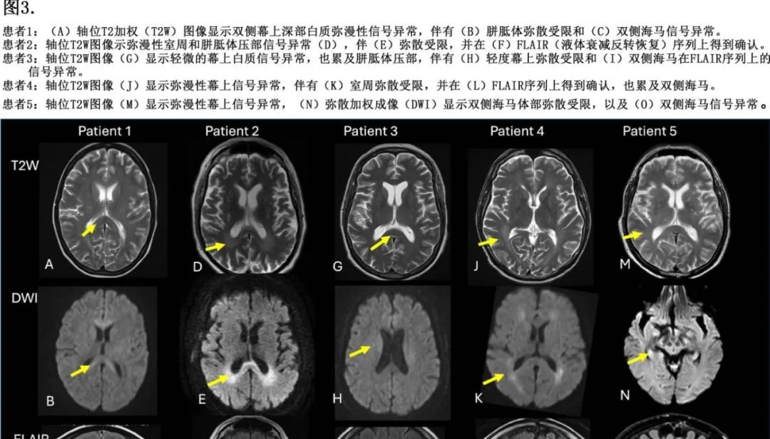 20250412_z0l74 20250412_z0l74