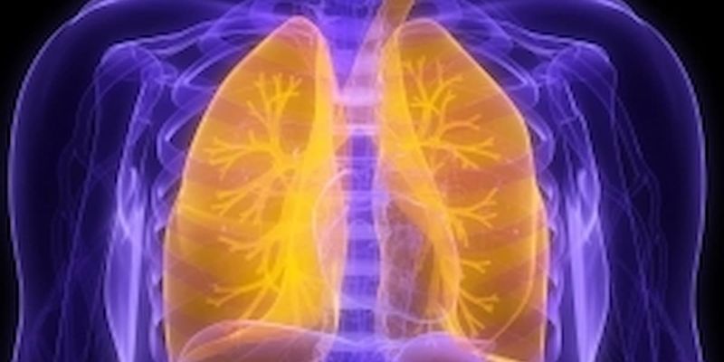 局限期小细胞肺癌（LS-SCLC）治疗新视角：同步放化疗时机与预后深度解析