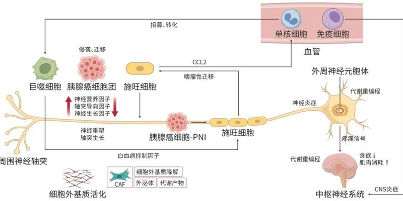 胰腺癌神经生态学：肿瘤进展、疼痛与耐药机制深度解析