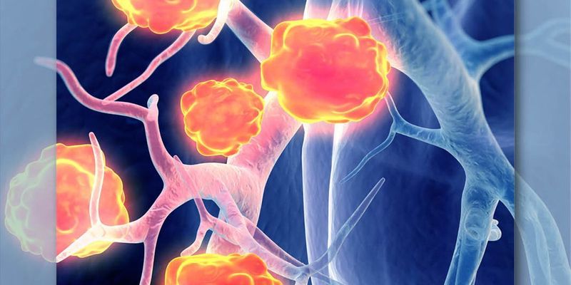 非小细胞肺癌一线治疗新突破：创新靶向药Ivonescimab（AK112）获国家药监局批准