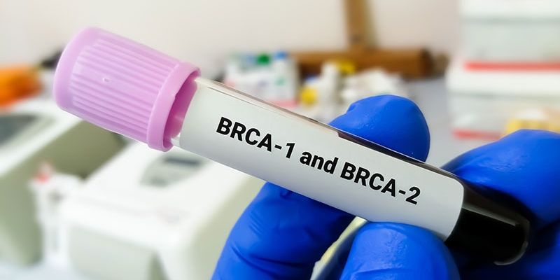 BRCA基因突变乳腺癌治疗新视角：保乳治疗与乳房切除术疗效相似研究公布