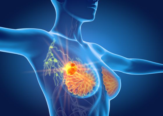 乳腺癌保乳手术切缘宽度新研究：1mm或2mm差异对复发影响不大？