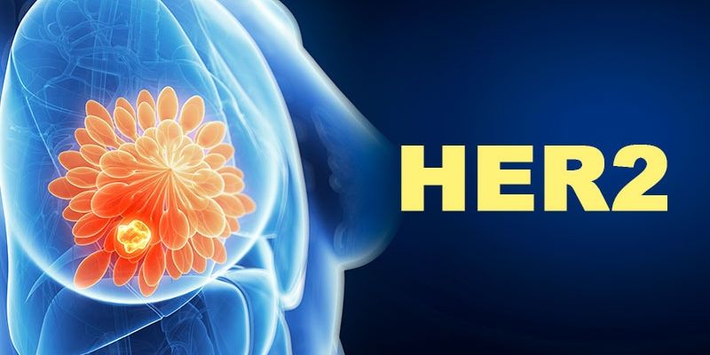 伊那沃利塞：PIK3CA突变乳腺癌治疗新里程碑