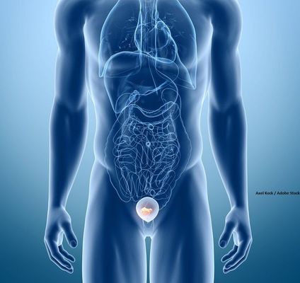 Anktiva与BCG联合治疗膀胱癌：长期研究显示卓越疗效