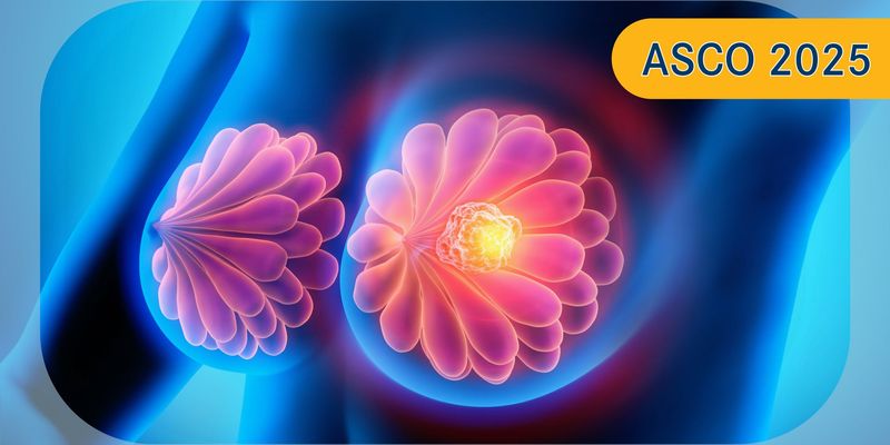Imulunestrant联合或不联合Abemaciclib：ER+/HER2–进展期乳腺癌患者生活质量显著改善