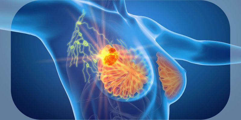 新型靶向药TQB2102:HER2-low乳腺癌治疗新突破,临床试验揭示显著疗效与良好耐受性