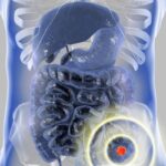 结直肠癌诊断顺序如何影响多原发恶性肿瘤患者生存期？最新研究揭示预后关键