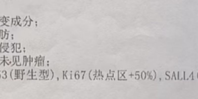 BRAF V600E突变肾母细胞瘤的靶向治疗新进展：达拉非尼与曲美替尼的突破性应用