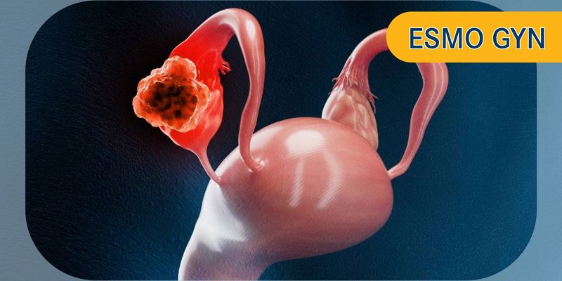 Raludotatug Deruxtecan (R-DXd)在铂敏感卵巢癌治疗中展现突破性疗效:最新临床研究进展