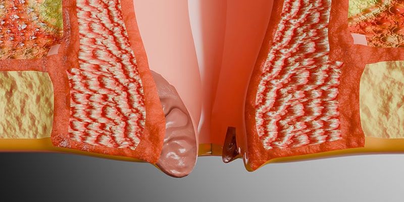 针对HIV阳性男同性恋者：35岁起肛门癌筛查的成本效益与生存获益