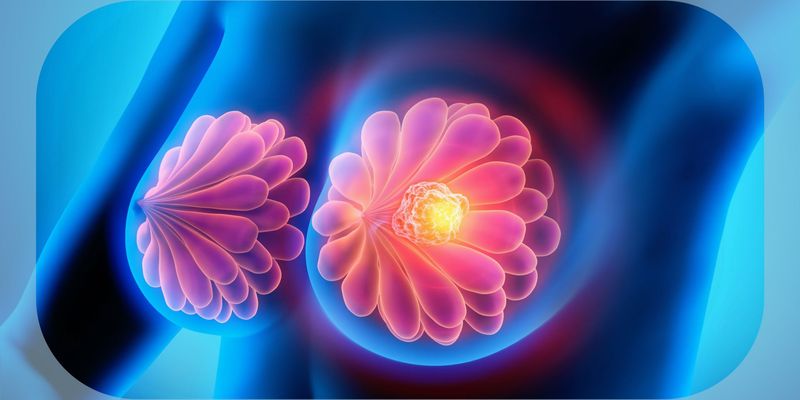 Vepdegestrant新药申请获FDA受理：ESR1突变ER+/HER2-转移性乳腺癌靶向治疗新突破