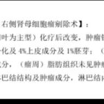 儿童双侧肾母细胞瘤WT1基因突变：诊疗、预后与靶向药代购全解析
