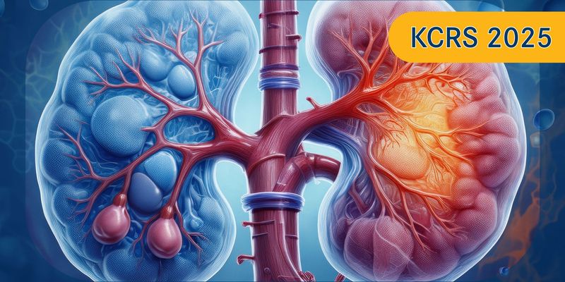 纳武利尤单抗治疗肾细胞癌新发现:CD163+巨噬细胞或可预测疗效