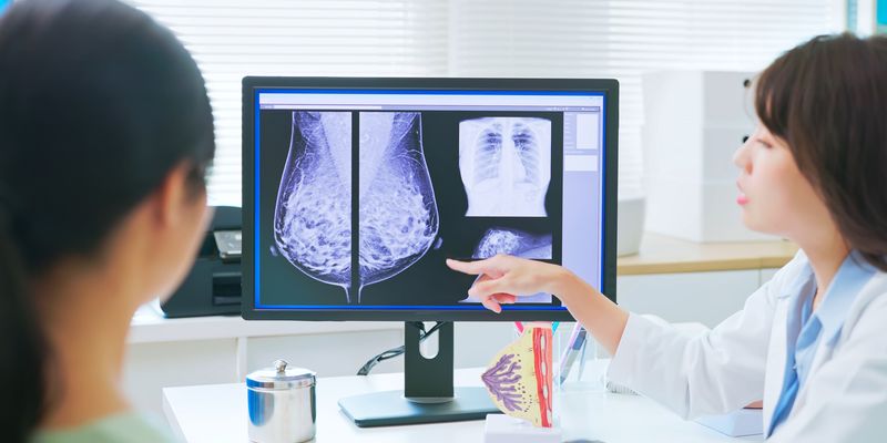 乳腺癌筛查迎来变革：AI技术如何揪出被遗漏的“间期癌”？