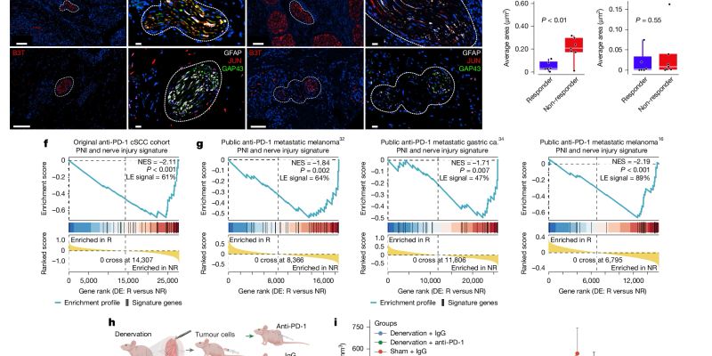 癌细胞如何“劫持”神经系统，导致PD-1抑制剂免疫治疗耐药？最新研究揭示癌症新机制