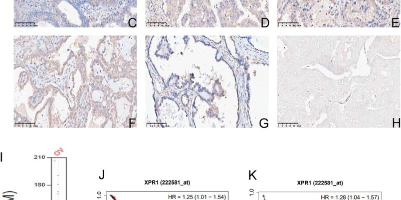 卵巢癌治疗新靶点发现:XPR1如何影响肿瘤生长与免疫治疗效果?