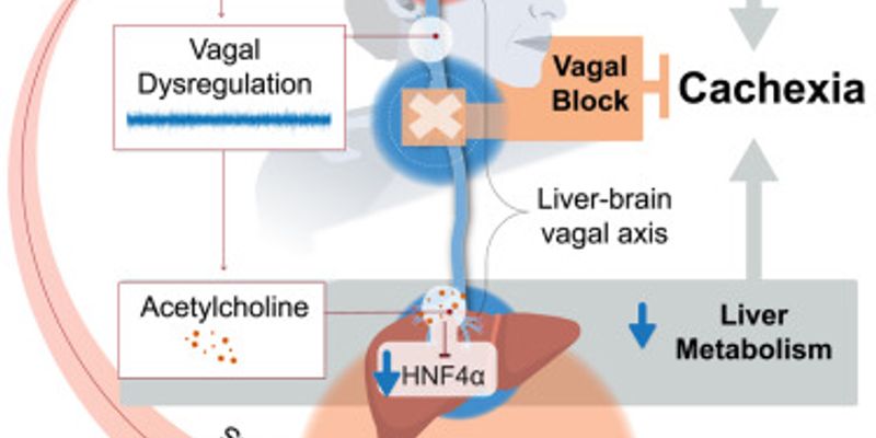 癌症恶病质新突破：阻断迷走神经有望逆转致命性体重下降