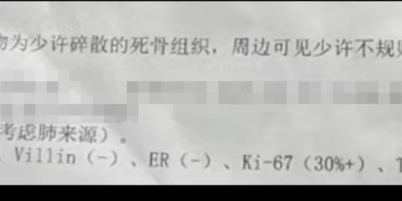 晚期肺腺癌EGFR G779F突变：靶向治疗新进展与用药选择