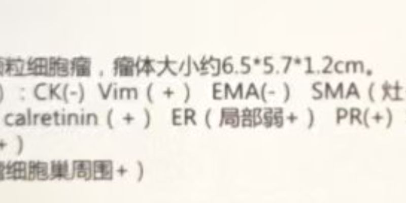 卵巢颗粒细胞瘤FOXL2基因突变解析:精准诊断与治疗决策的关键