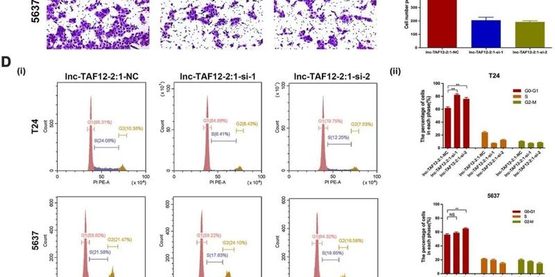 膀胱癌新发现：尿液检测或可预测病情，lnc-TAF12-2:1成治疗新靶点